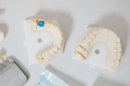 Clear Aligners vs. Veneers: Pros and Cons