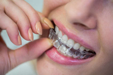 Retainers After Braces or Aligners: Why Theyβre the Key to a Lasting Smile