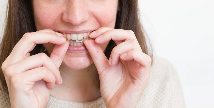 The Best Candidates for Invisible Aligners: Are They Right for You?