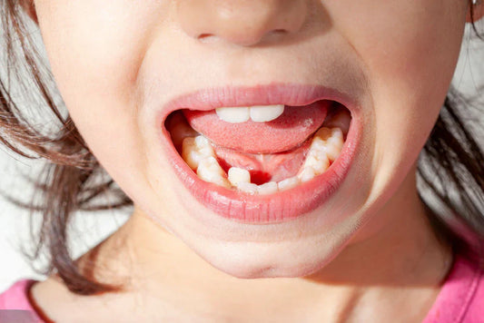 Addressing Minor vs. Major Teeth Misalignments: Treatment Options