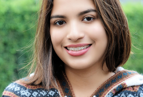 Clear Aligners vs Ceramic Braces: Real Differences in Comfort, Look & Cost