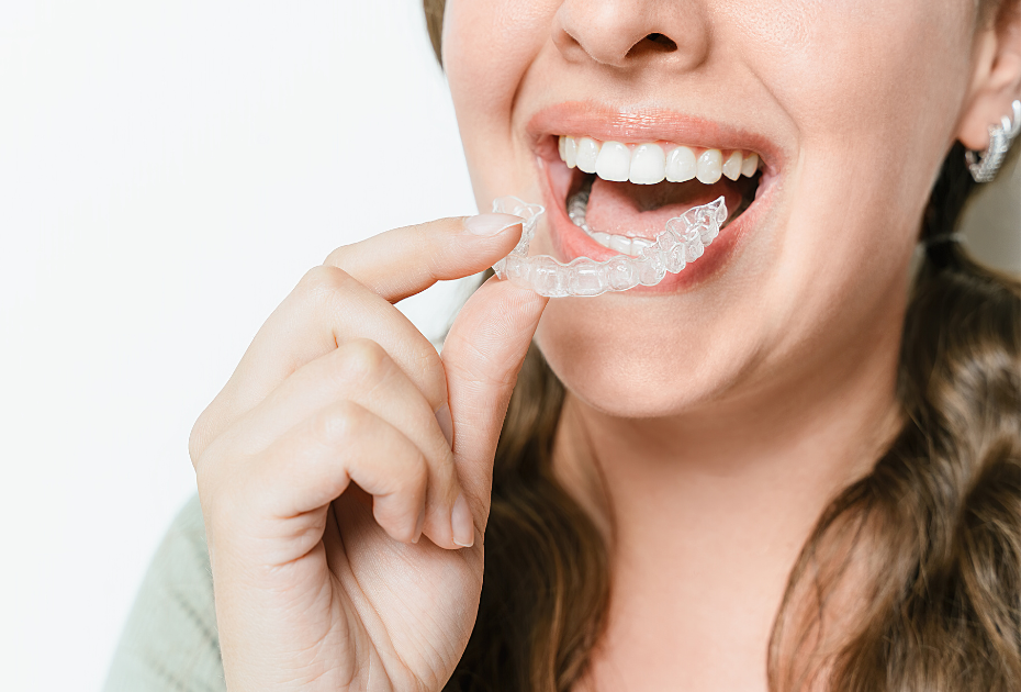 At-Home Clear Aligners vs In-Clinic Clear Aligners in Europe: Key Differences