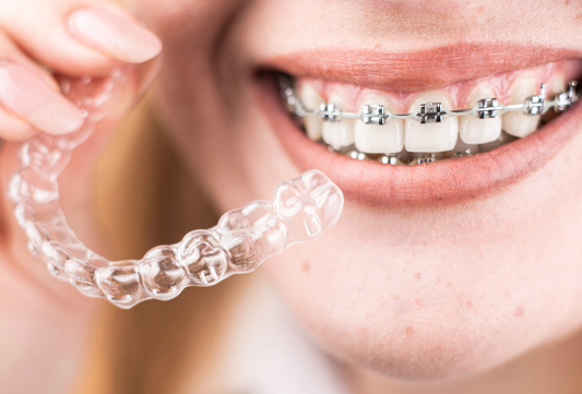Person holding clear aligner next to teeth with metal braces showing clear aligners vs braces for bite correction.
