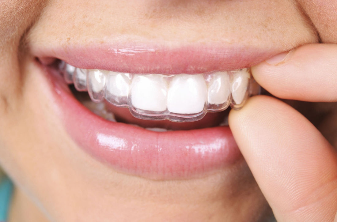 Transform Your Smile: How Clear Aligners Are Revolutionizing European Orthodontics